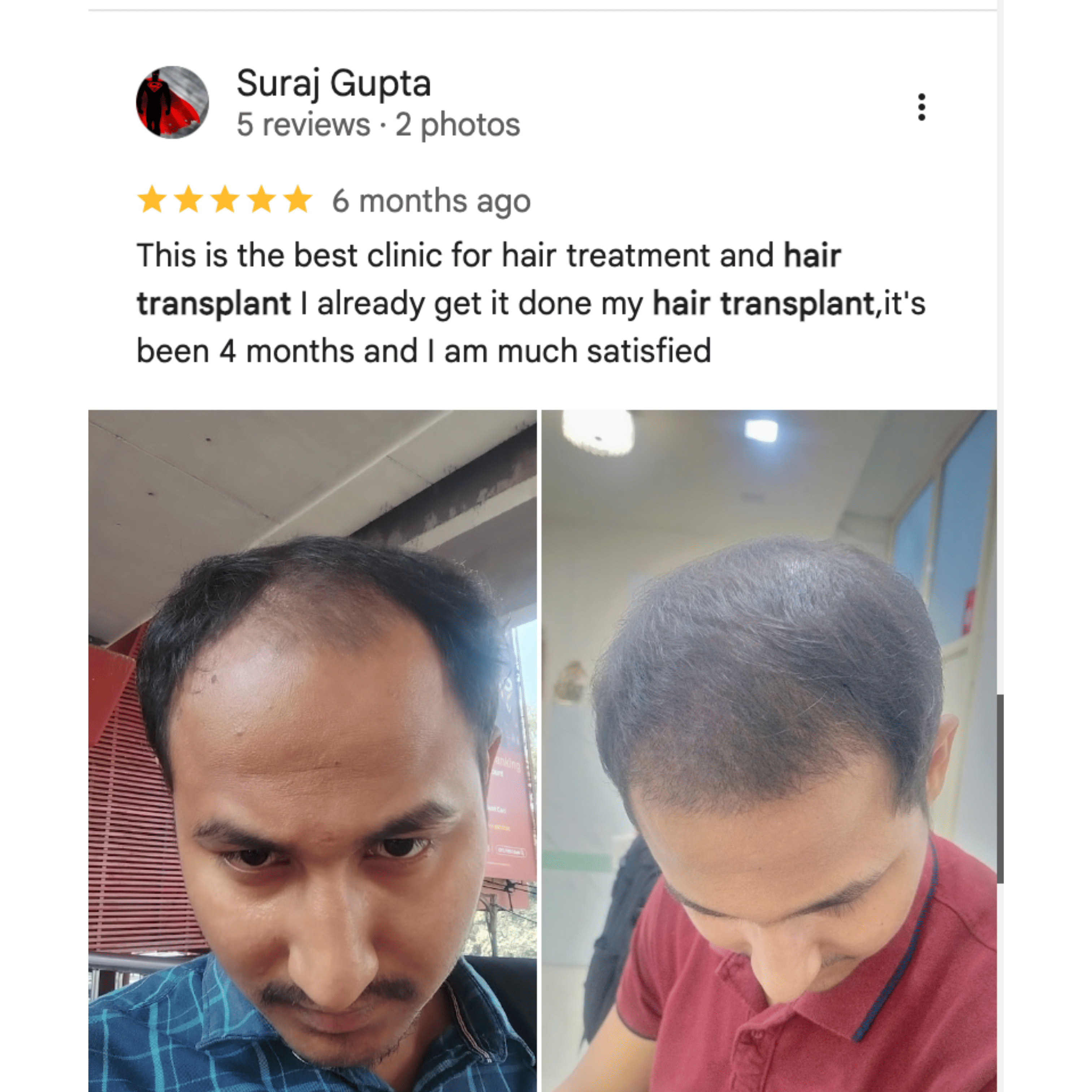 Review Card 5